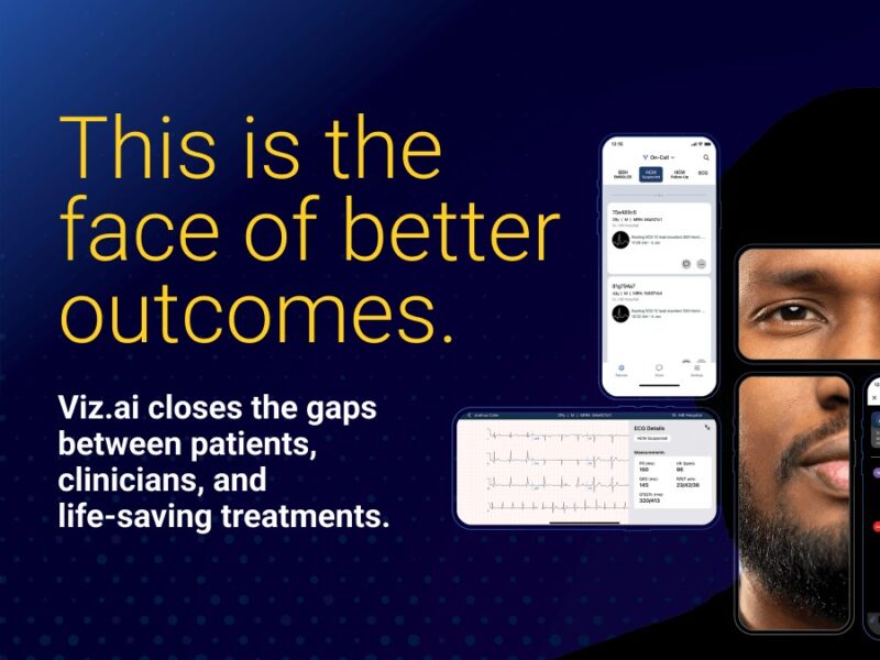 Viz.ai